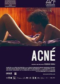 Acnee (2008)