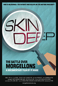 Skin Deep: The Battle Over Morgellons (2020)